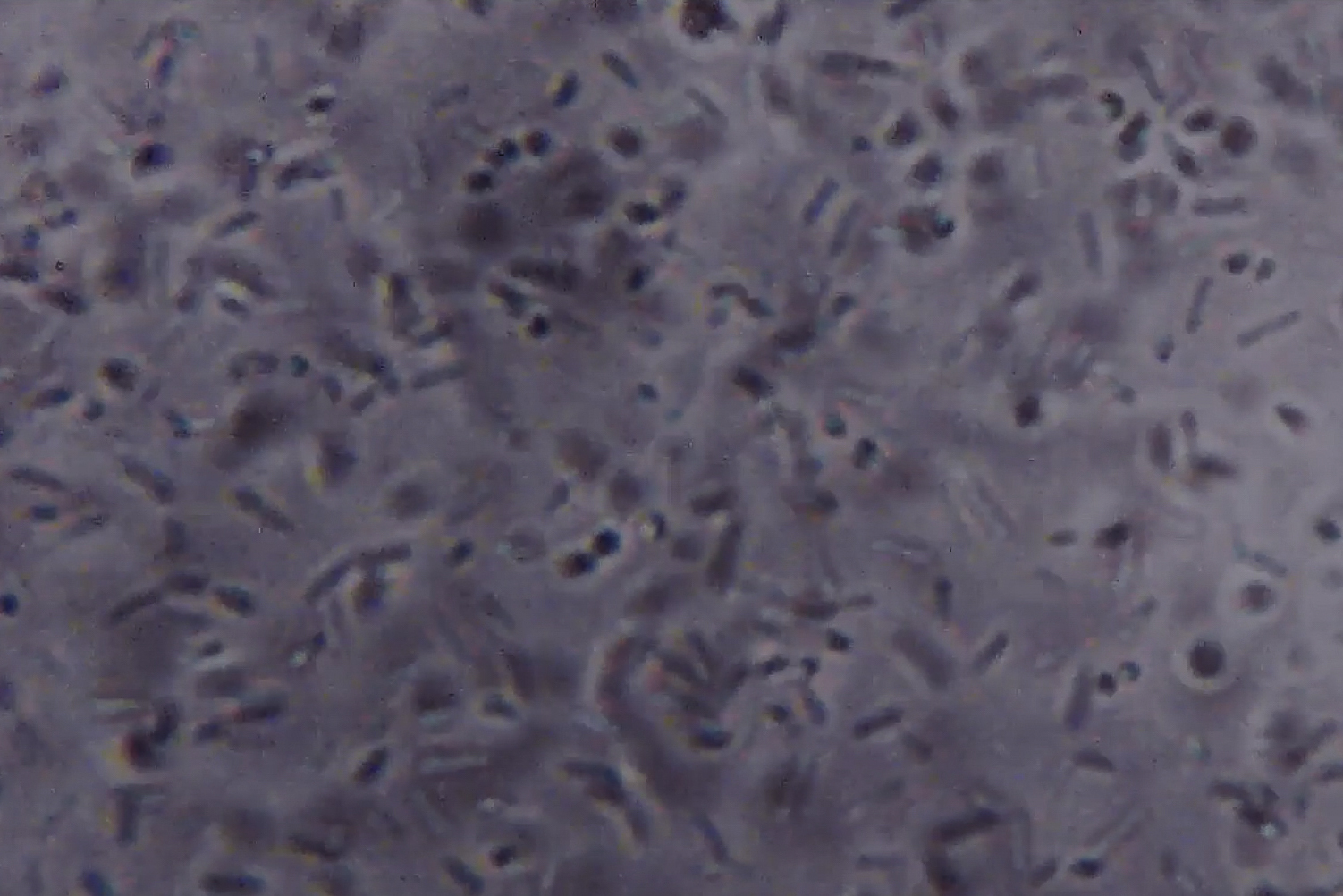 microscope, e.coli, escherichia coli, video, microscopic photography, fake documentary