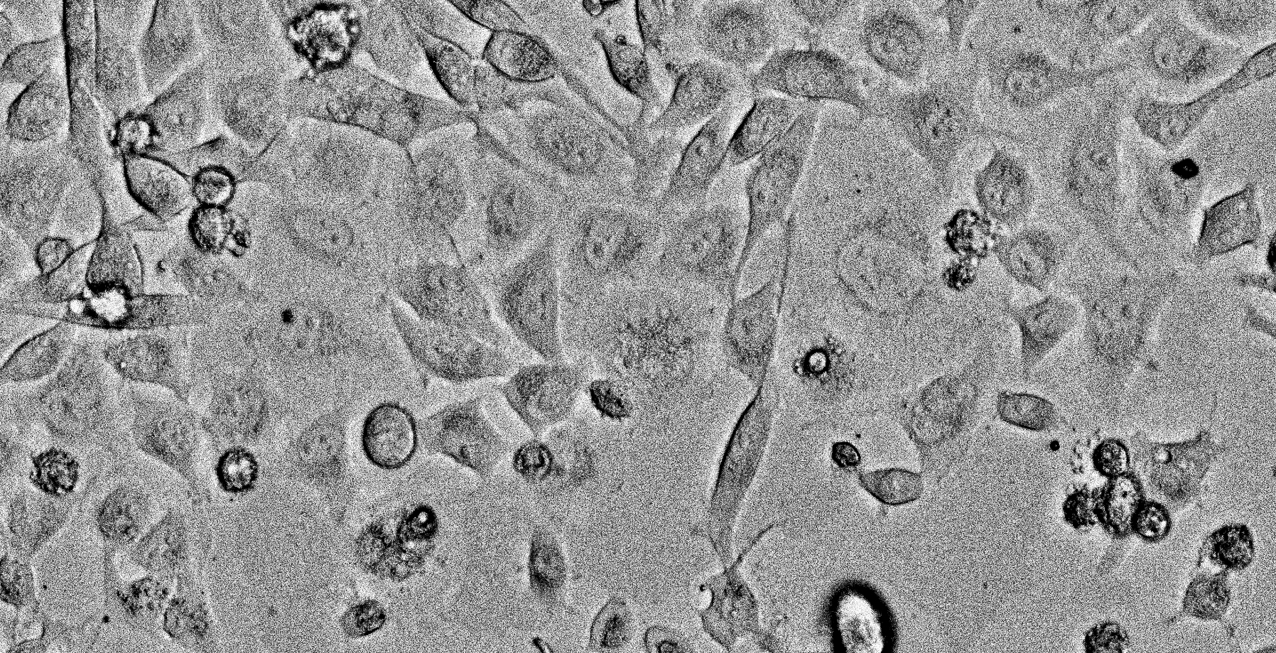 art, microscope, microscopic photography, cell, cell death, apoptosis, hela apoptosis, art and science