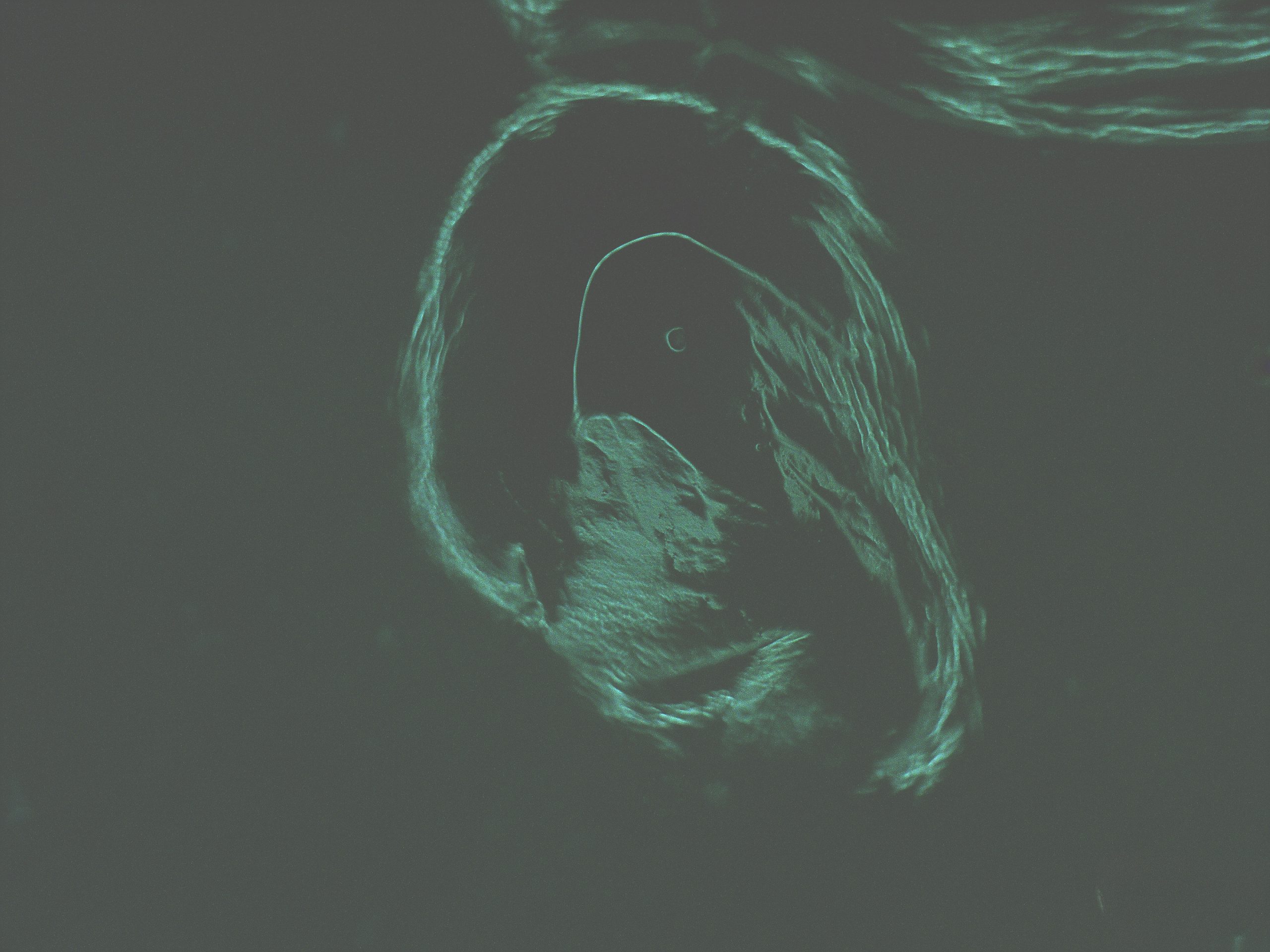cellulose, bioart, after-image, bacterial cellulose, bacterial pigment, algae, cellulomonas, microscopic imaging, art and science